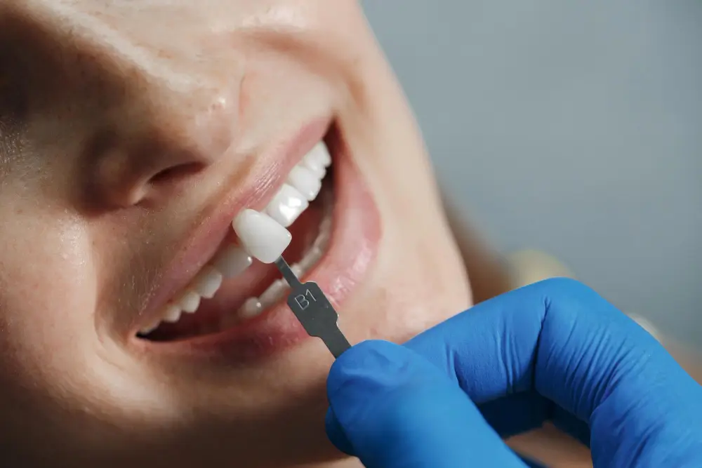 Dentiste à Béni Mellal